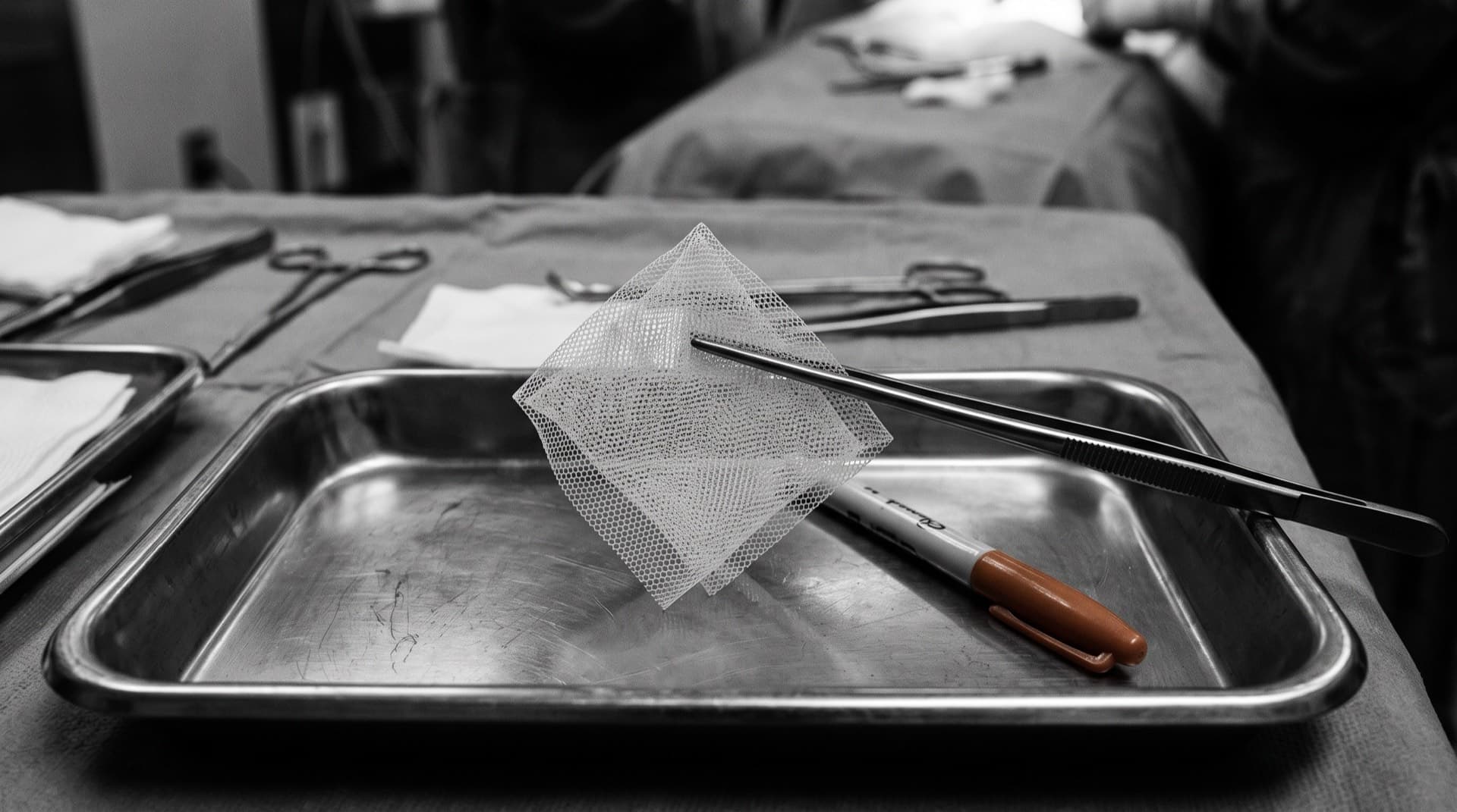 Surgical mesh held in forceps over a stainless tray (photo illustration)
